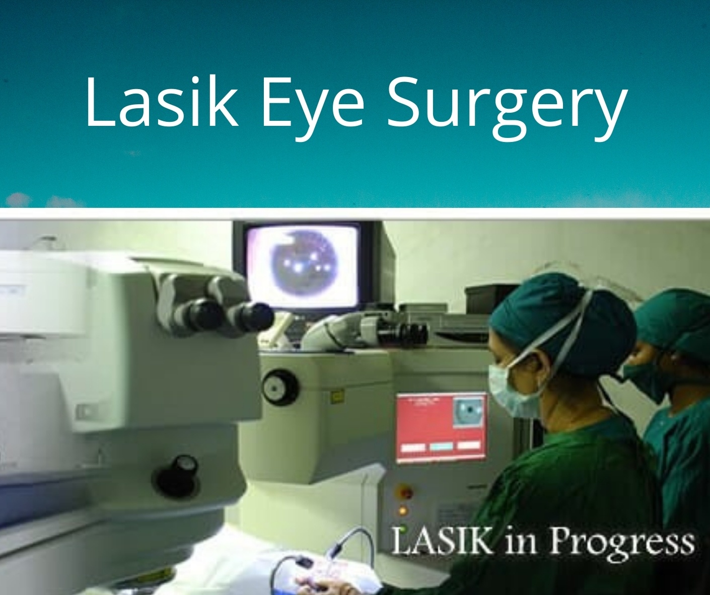 LASIK Eye Surgery
