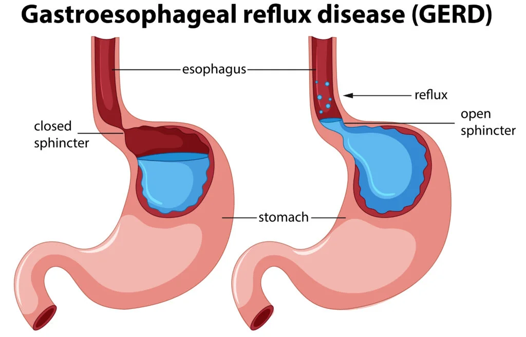 Dr. Rachit Agarwal – Gastroenterologist in Nagpur